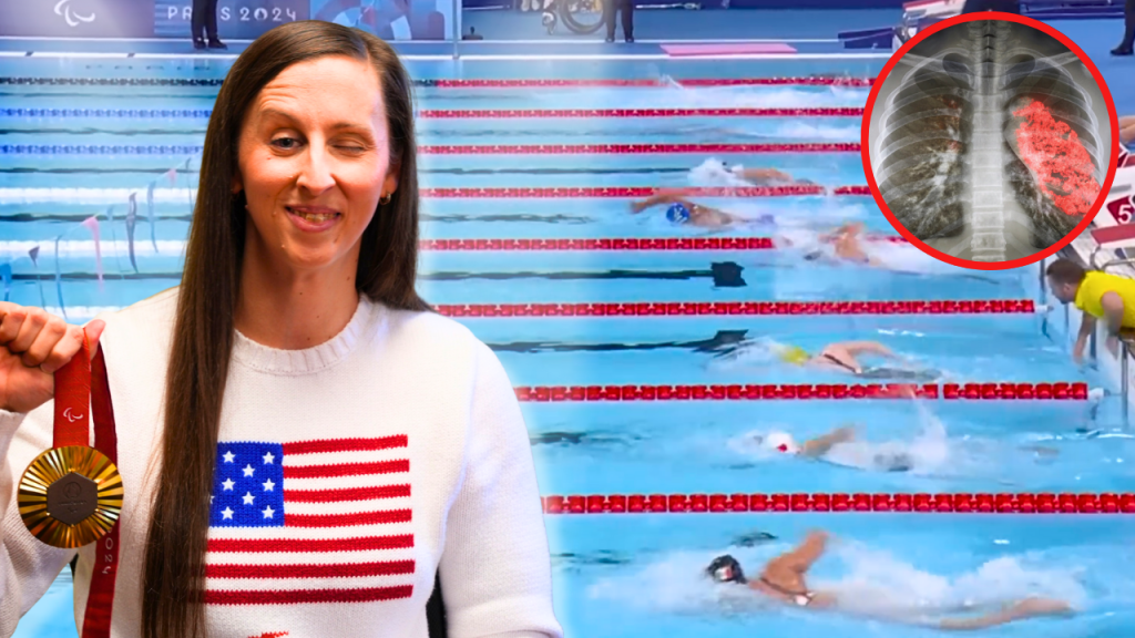 A Paralympic swimmer wearing a white sweater with an American flag holds up a gold medal and smiles in the foreground. Behind her, swimmers race in a pool with lane lines visible. In the top right corner, a circular graphic shows a chest X-ray with one lung highlighted in red, referencing a medical incident.